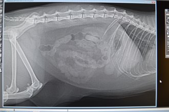 Röntgenbild mit "Girlandendarm"